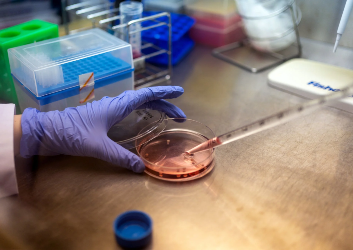 手袋をはめた研究者がピペットを使い、赤い液体が入った培養皿に液体を滴下している様子を捉えた画像です。科学実験または研究室での作業風景を示しています。