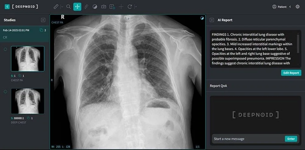 DEEPNOIDの医療画像ソフトウェアの画面