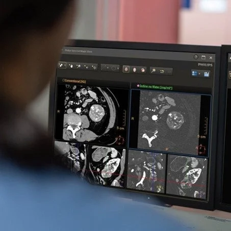 医師がCTスキャン画像を分析している様子