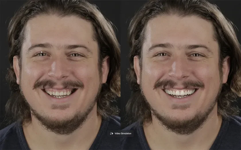 ビフォー&アフター