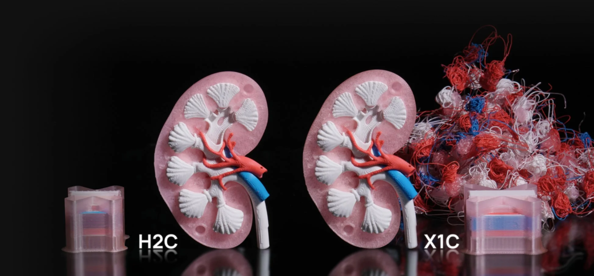 廃棄物比較を示す腎臓の解剖学的モデル