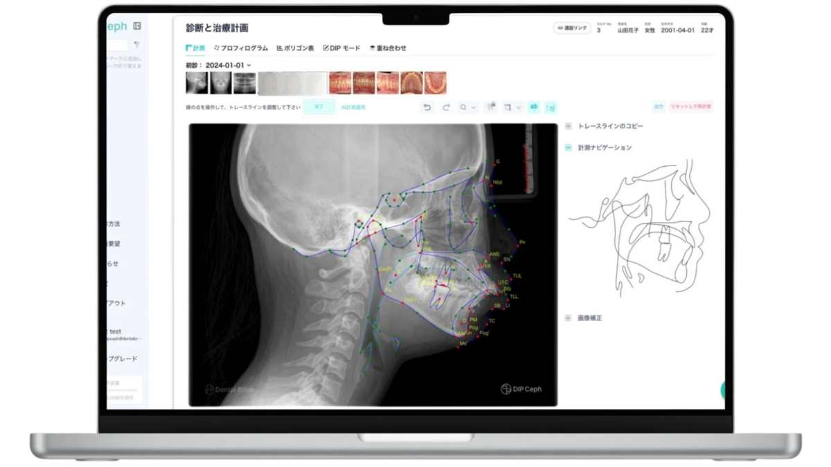 DIP Cephの画面イメージ